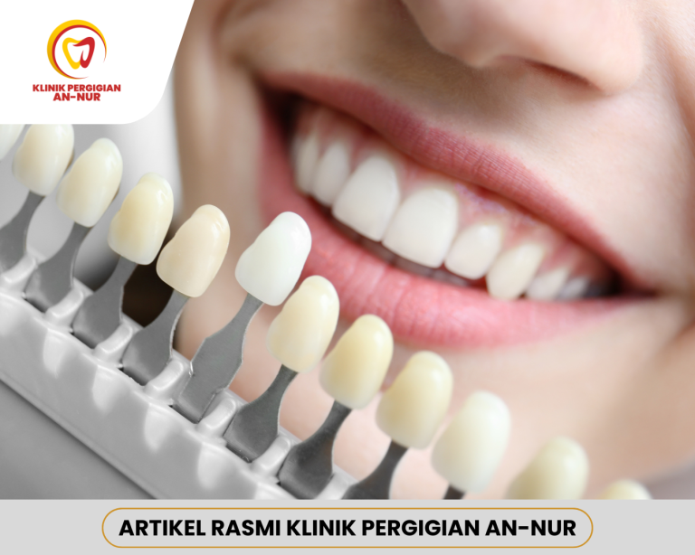 Kesan Jika Tidak Whitening