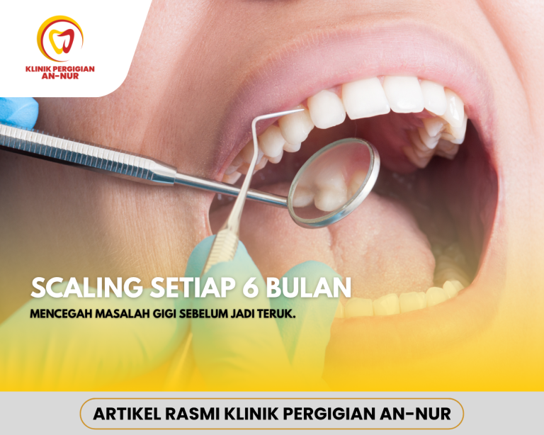 Artikel web scaling 6 bulan